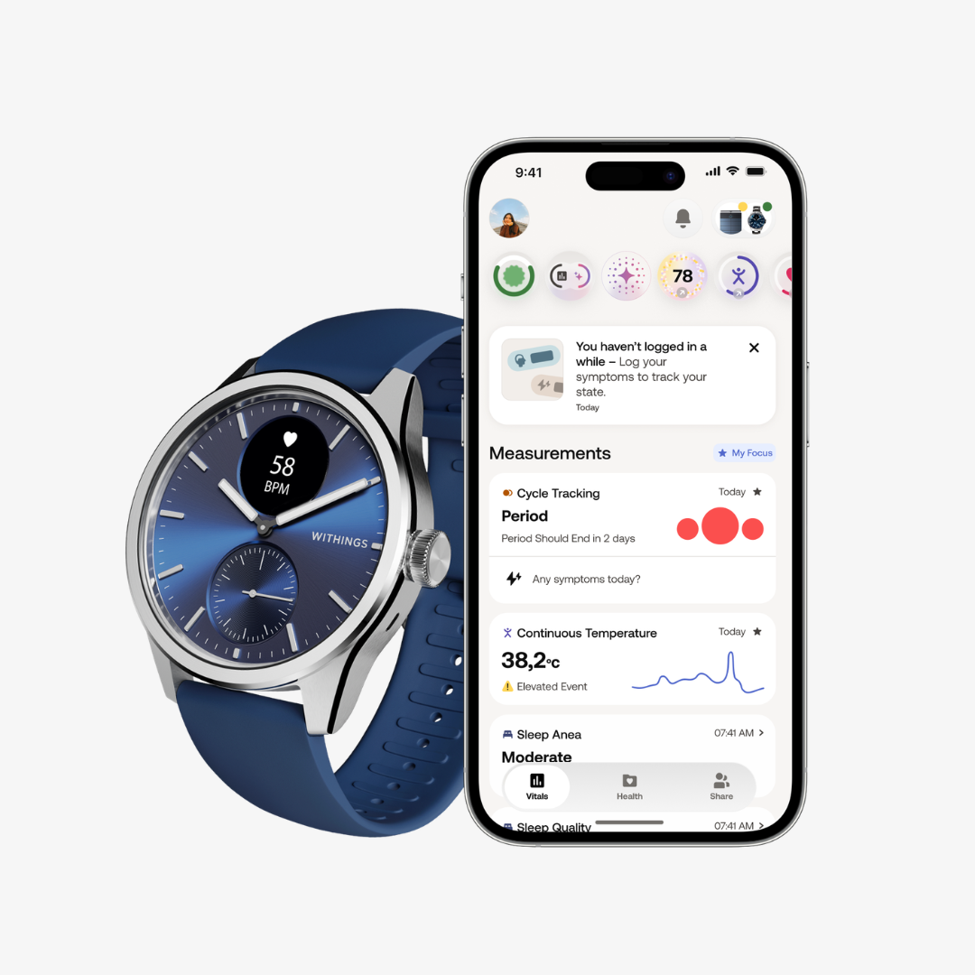 Scanwatch 2 - Blue - Image 5