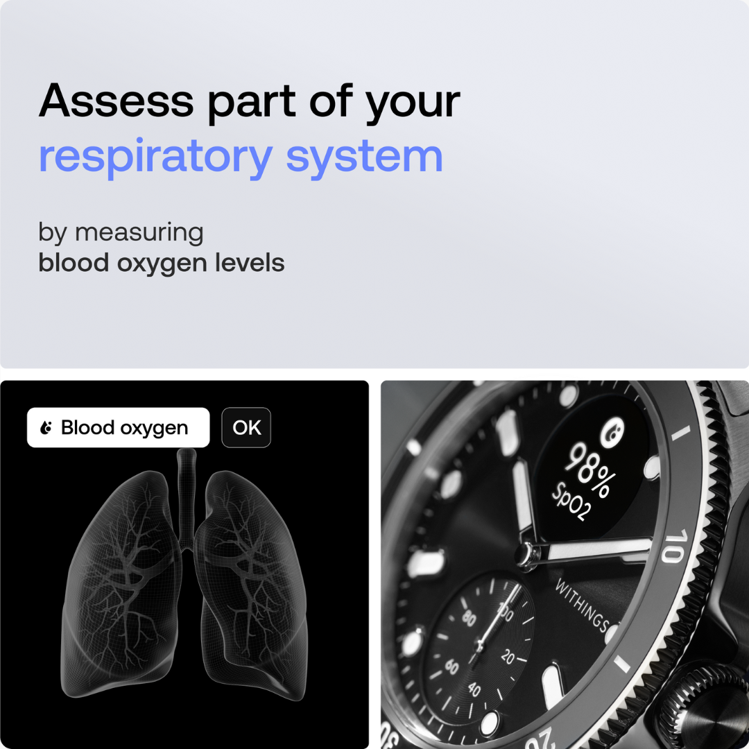 Scanwatch Nova - Black - Image 4